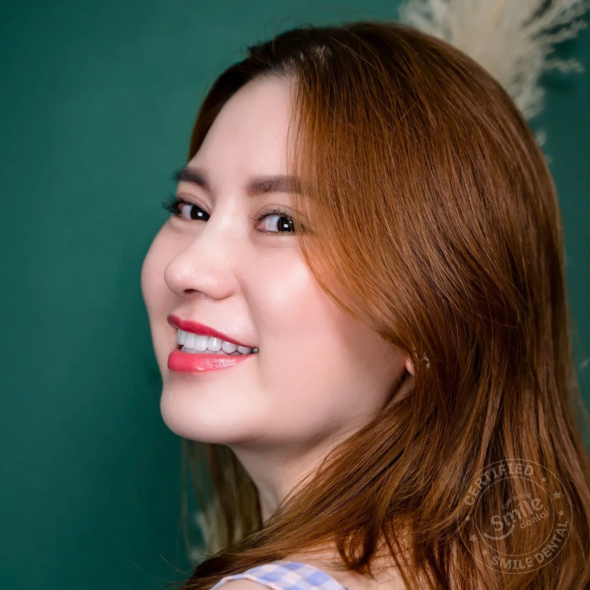 Ảnh 5 của Nha Khoa Smile - Cần Thơ
