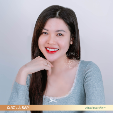 Chị Khả Di, 22 Răng sứ DDBio