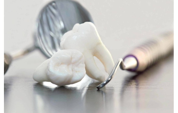 Quality Dental Services – General & Cosmetic Care at Smile Dental