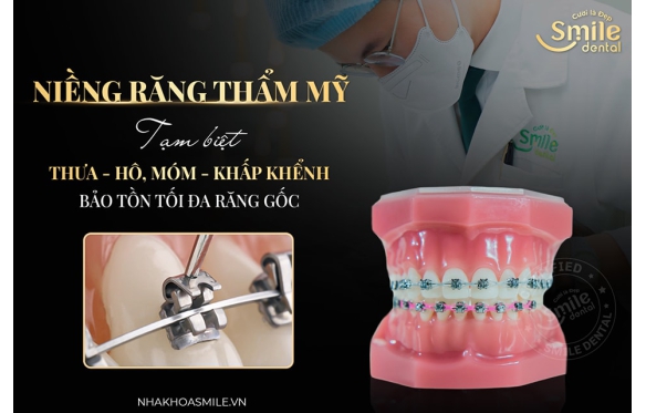 Niềng Răng Mắc Cài Pha Lê: Lựa Chọn Tối Ưu tại Nha Khoa Smile