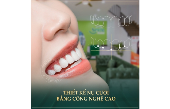 Mẹo Làm Sáng Răng Sứ Đơn Giản Tại Nhà: Giữ Nụ Cười Luôn Rạng Rỡ Cùng Nha Khoa Smile