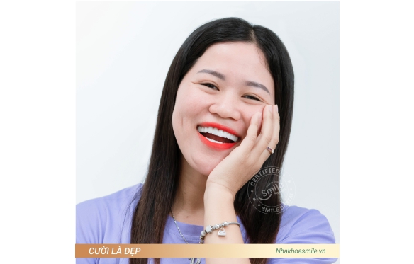 Răng Sứ Bền Đẹp Cần Thơ - Bảng Giá & Ưu Đãi 2025 Tại Nha Khoa Smile