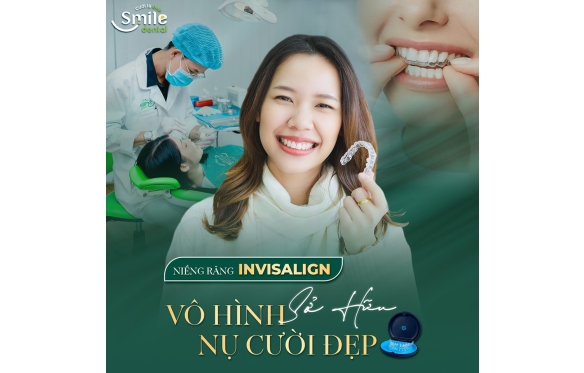 Niềng Răng Invisalign – Nha Khoa Smile