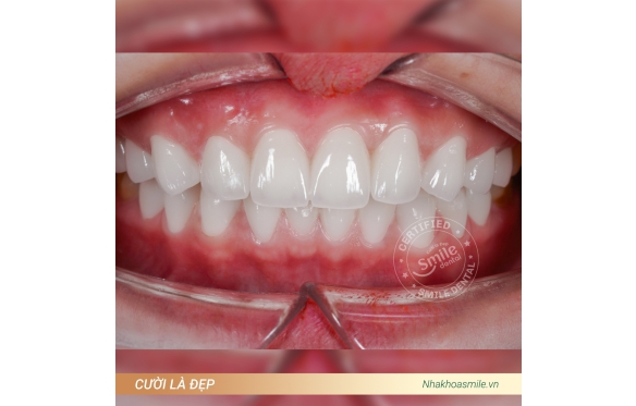 Trusted Dental Care Services – Smile Dental