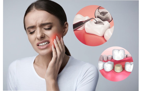 Răng Sứ Cho Răng Sâu Cần Thơ | Khắc Phục Triệt Để, Ngăn Ngừa Tái Phát | Smile Dental