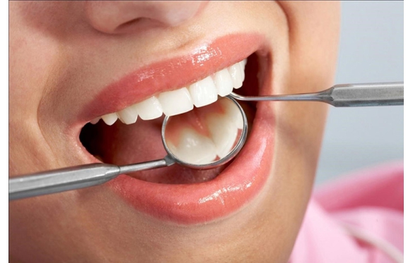 Chữa Tủy Nội Nha Răng Cửa Tại Nha Khoa Smile – Bảo Vệ Nụ Cười Của Bạn