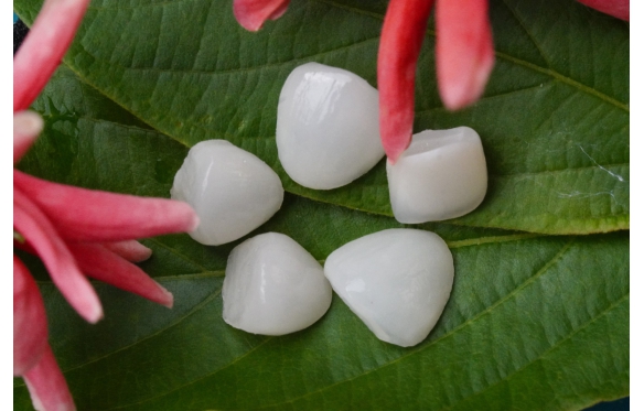 Nâng Cấp Nụ Cười Với Dịch Vụ Dán Sứ Veneer Tại Nha Khoa Smile Cần Thơ