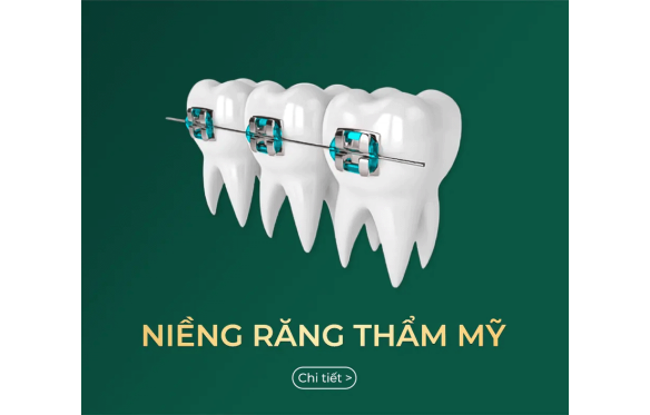 Nha Khoa Smile Bạc Liêu - Niềng Răng Đạt Chuẩn Quốc Tế