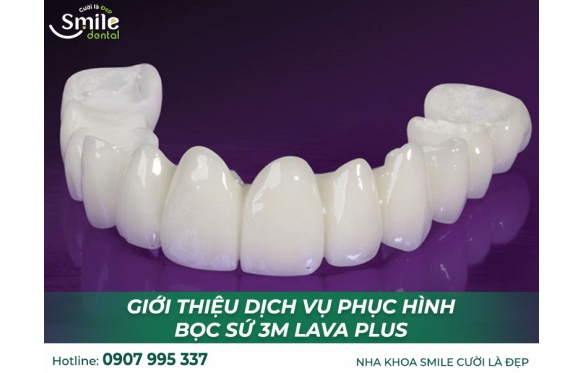 Bọc Răng Sứ 3M Lava Plus Tại Nha Khoa Smile Miền Tây Bạc Liêu