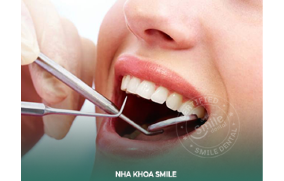 Nhổ Răng Cửa: Quy Trình An Toàn & Uy Tín tại Nha Khoa