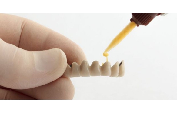 Cách Chọn và Sử Dụng Keo Dán Răng Sứ Hiệu Quả: Keo Tạm Thời, Vĩnh Viễn,Tháo Lắp, Cố Định