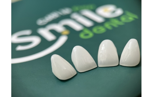 Smile Dental Cà Mau: Leading in Oral Health Care