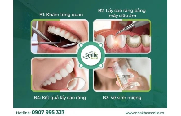Dịch vụ nha khoa tổng quát Bạc Liêu | Nha Khoa Smile