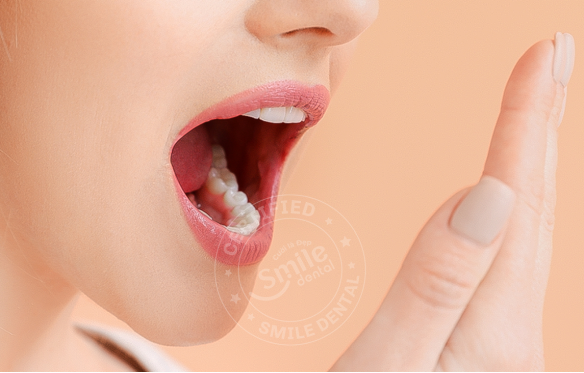 Bọc răng sứ có bị hôi miệng không? Tác hại? Cách khắc phục hiệu quả?