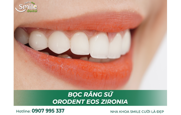 Răng Sứ Orodent EOS: Lựa Chọn Hoàn Hảo Tại Nha Khoa Smile Kiên Giang