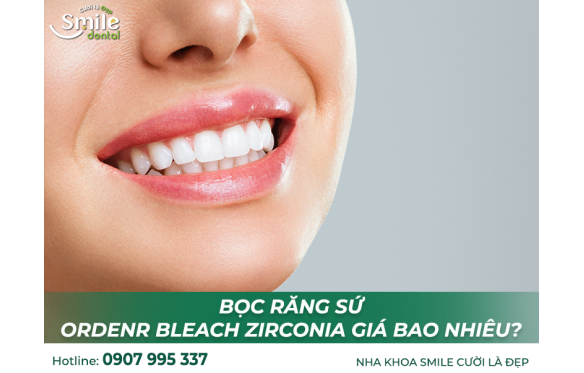 Trồng Răng Sứ Orodent Bleach tại Nha Khoa Smile Cần Thơ