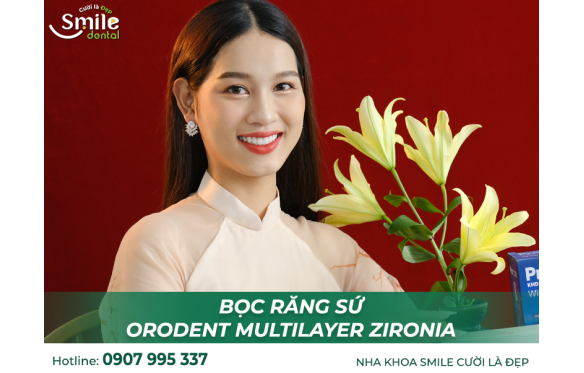 Răng Sứ Cao Cấp Orodent Multilayer Giá Tốt tại Nha Khoa Smile Cần Thơ