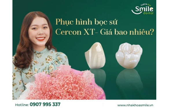 Giá Răng Sứ Cercon: Bảng Giá Chi Tiết Và Đánh Giá Về Độ Bền Của Các Loại Sứ Cercon