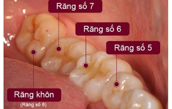 Răng Số 5, 6, 7 Và 8: Thông Tin Chi Tiết Và Giải Pháp Cho Các Vấn Đề Phổ Biến Với Chuyên Gia Từ Nha Khoa Smile