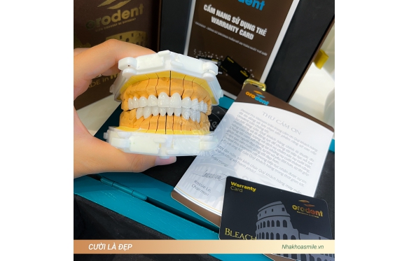 Làm răng sứ Lava 3M - Địa điểm uy tín hàng đầu về nha khoa Smile Dental