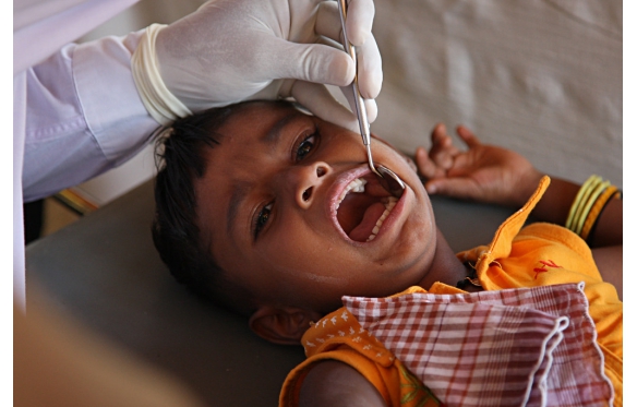 Nha sĩ trẻ em Kiên Giang – Vì sao cần chọn đúng nơi, đúng người? | Smile Dental