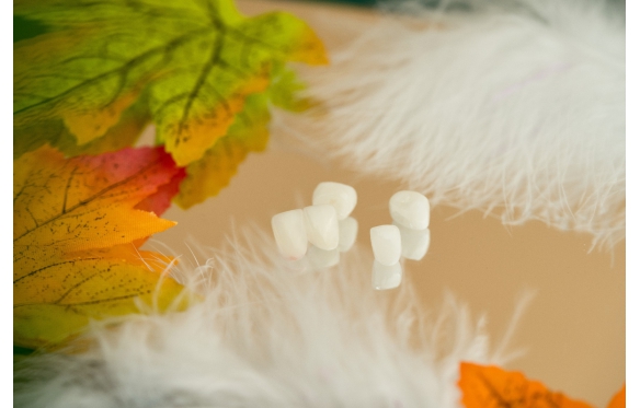 Tổng hợp thông tin về răng sứ Lava 3M tại Nha Khoa Smile Cà Mau