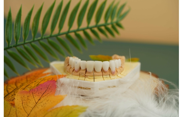 Quy trình trồng răng sứ tại Nha Khoa Smile: Chuyên nghiệp và Nhanh chóng