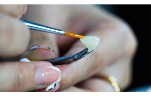 Răng Sứ 1 Cái Bao Nhiêu Tiền? Chi Phí Bọc Sứ Và Những Yếu Tố Ảnh Hưởng Theo Phân Tích Từ Nha Khoa Smile