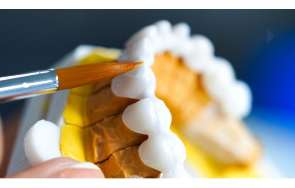 Răng sứ Zirconia có bị đổi màu không? Duy trì màu sắc và tính thẩm mỹ với Nha Khoa Smile