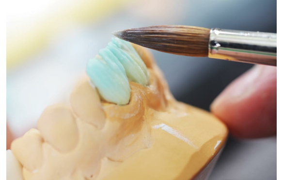 Các Loại Răng Sứ Đặc Biệt: So Sánh và Lựa Chọn Phù Hợp Với Bạn Theo Nha Khoa Smile