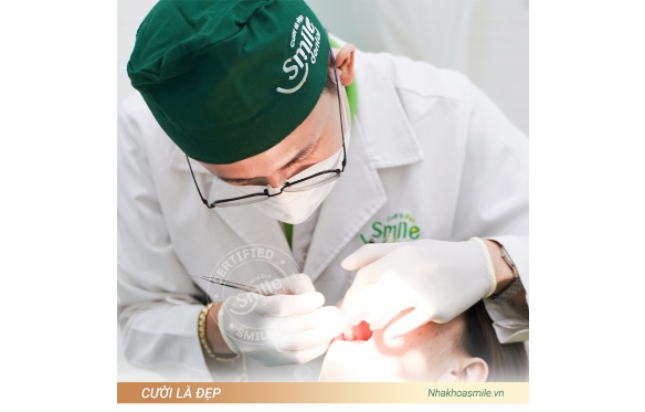 Nha Khoa Smile Hướng Dẫn Cách Chăm Sóc và Vệ Sinh Răng Sứ, Cầu Răng Sứ Đúng Cách Để Bền Lâu