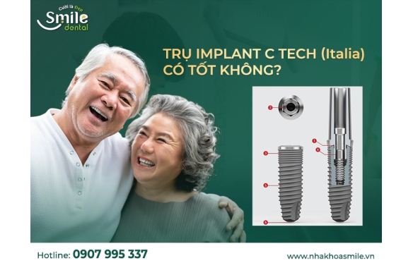 Giá Implant C-Tech tại Nha Khoa Smile: Chất lượng vượt trội, bảo hành 15 năm