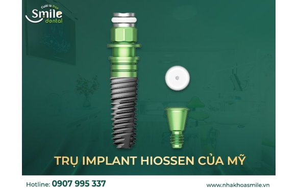 Giá Implant Hiossen: Giải Pháp Cấy Ghép Chất Lượng tại Smile