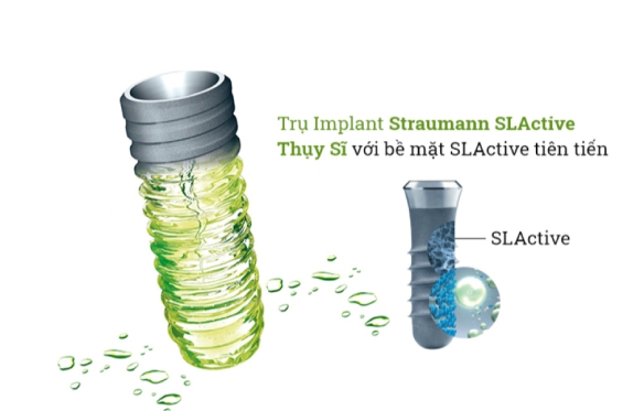 Implant Straumann Giá Bao Nhiêu? Tìm Hiểu tại Nha Khoa Smile