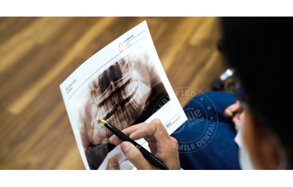 Niềng Răng Sứ Tại Nha Khoa Smile - Giải Pháp Thẩm Mỹ Và Hiệu Quả