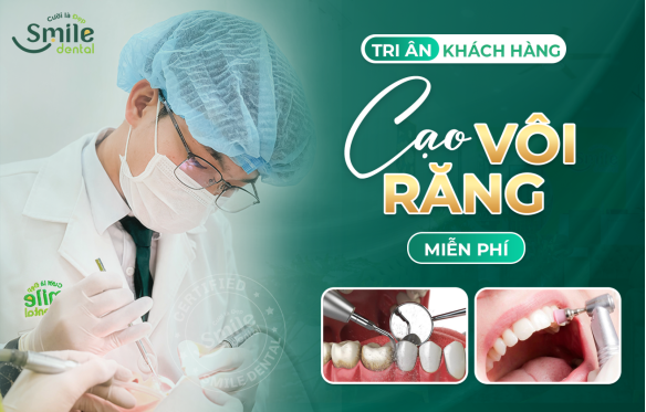 ƯU ĐÃI CẠO VÔI RĂNG MIỄN PHÍ