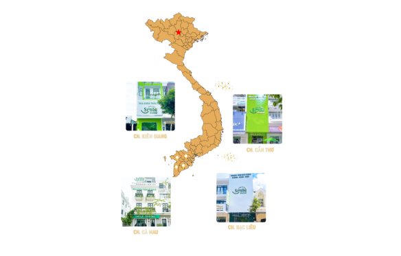 Bản Đồ Các Phòng Khám Nha Khoa Làm Răng Sứ Tại Cần Thơ