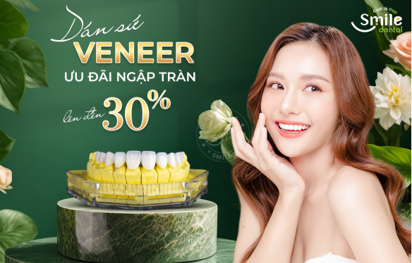ƯU ĐÃI DÁN SỨ VENEER