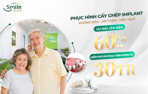 ƯU ĐÃI TRỒNG RĂNG IMPLANT