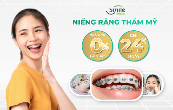 NIỀNG RĂNG ƯU ĐÃI