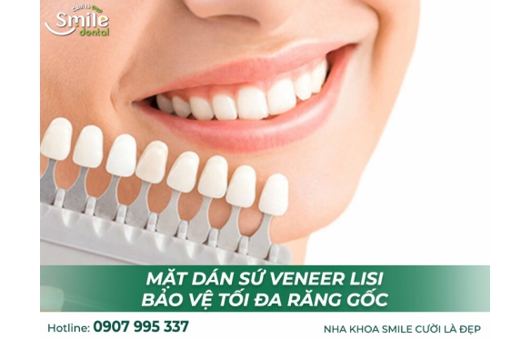 Giải Pháp Dán Răng Sứ Tại Nha Khoa Smile Bạc Liêu Cho Hàm Răng Của Quý Khách