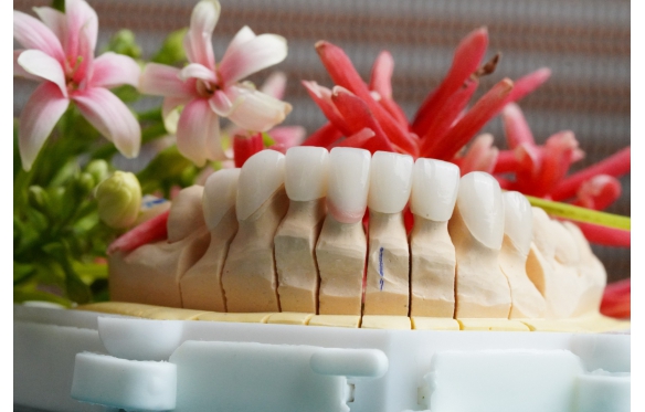 Dịch Vụ Bọc Răng Sứ Tại Hậu Giang - Nha Khoa Smile