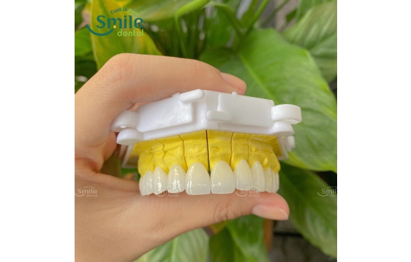 Chi Tiết về Giá Cả Và Chất Lượng Làm Răng Sứ Tại Nha Khoa Smile Bạc Liêu