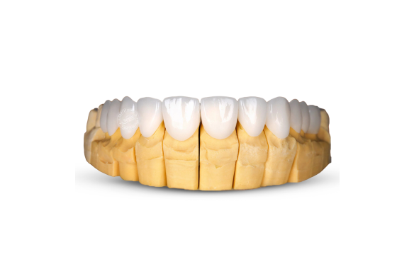 Làm Răng Sứ Zirconia Cao Cấp Tại Nha Khoa Smile