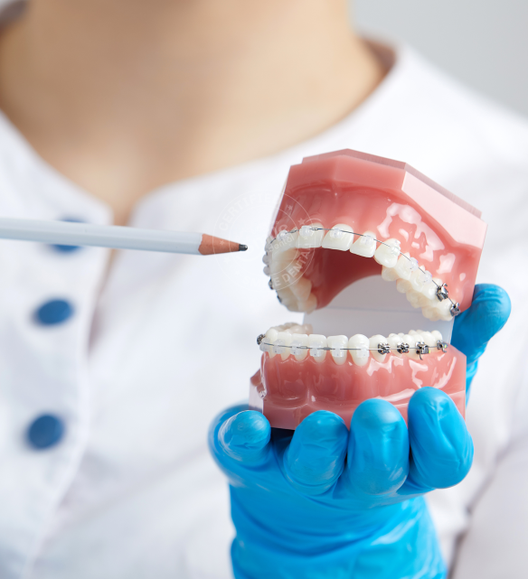 Các phương pháp " chỉnh nha " phổ biến ưa chuộng nhất hiện nay